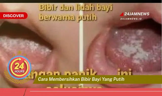 cara membersihkan bibir bayi yang putih