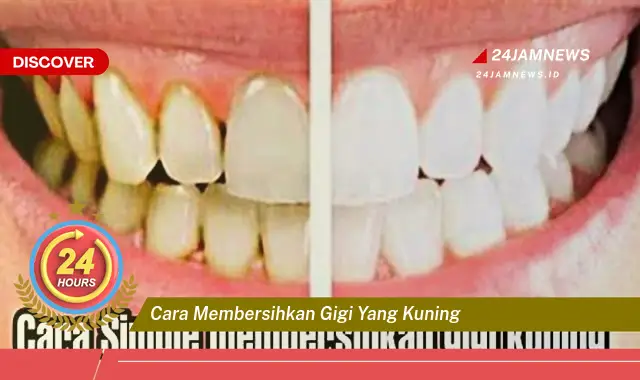 cara membersihkan gigi yang kuning