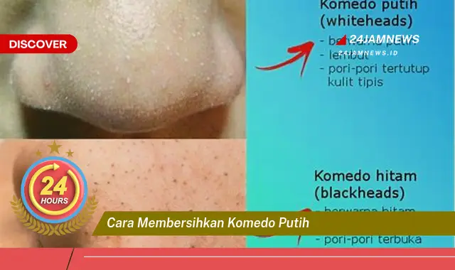 cara membersihkan komedo putih