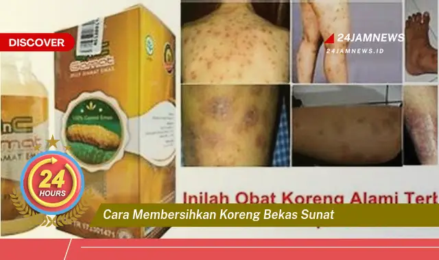 cara membersihkan koreng bekas sunat