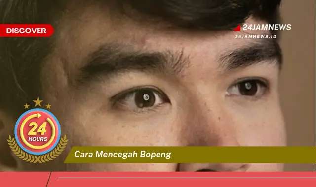 cara mencegah bopeng