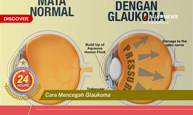 cara mencegah glaukoma