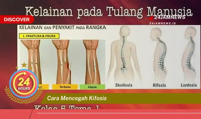cara mencegah kifosis