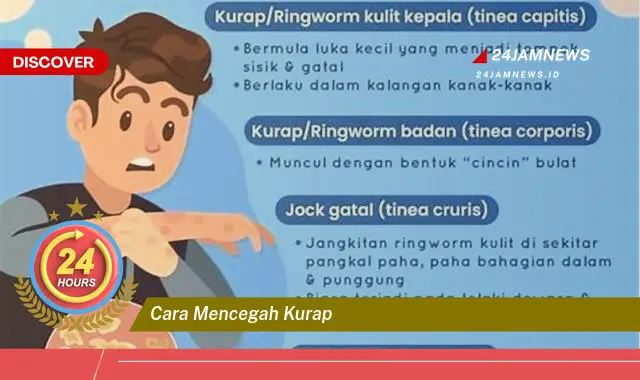 cara mencegah kurap