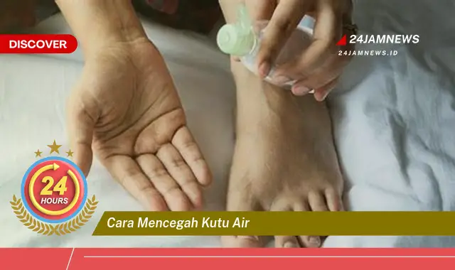 cara mencegah kutu air