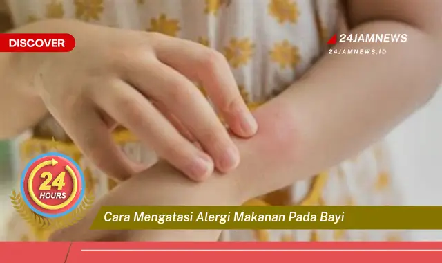 cara mengatasi alergi makanan pada bayi