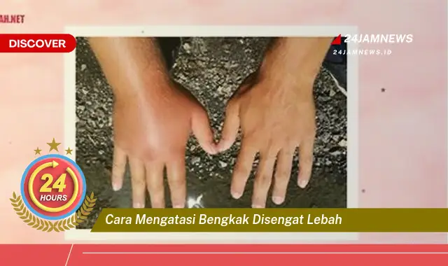 cara mengatasi bengkak disengat lebah
