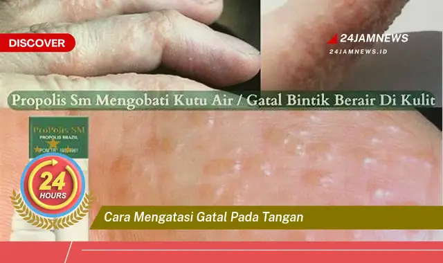 cara mengatasi gatal pada tangan