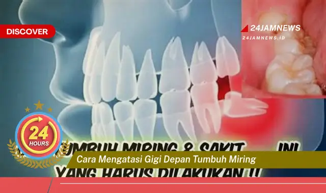 cara mengatasi gigi depan tumbuh miring