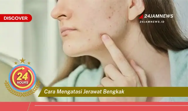 cara mengatasi jerawat bengkak