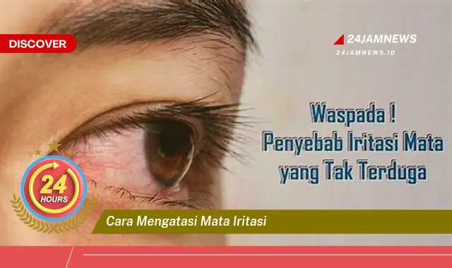 cara mengatasi mata iritasi
