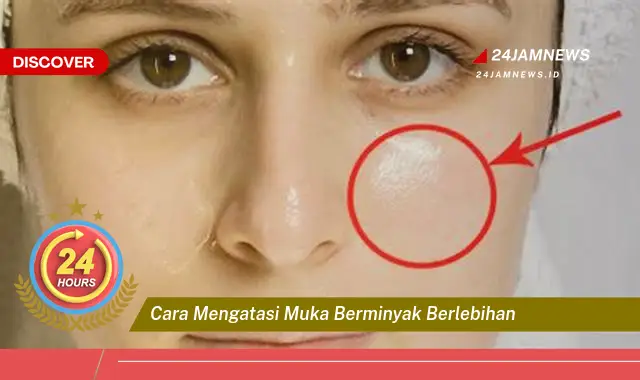cara mengatasi muka berminyak berlebihan