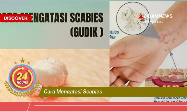 cara mengatasi scabies