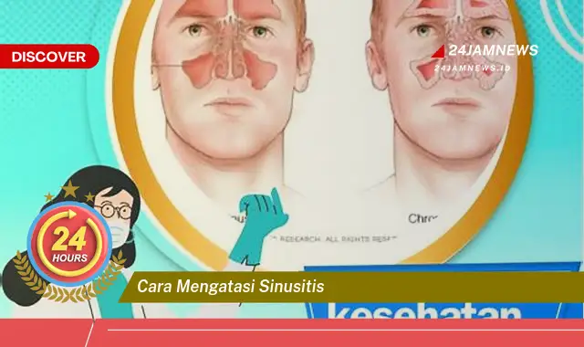 cara mengatasi sinusitis