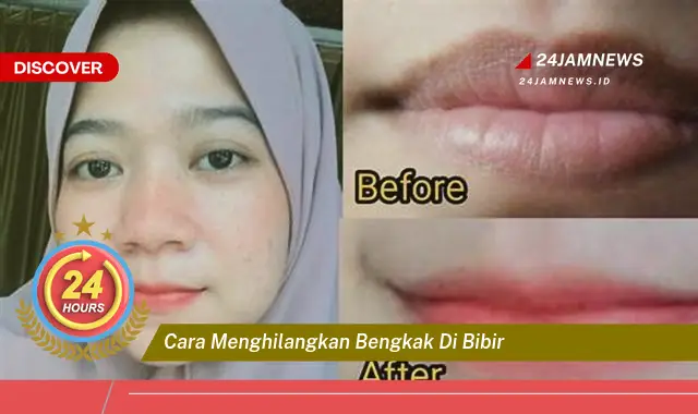 cara menghilangkan bengkak di bibir