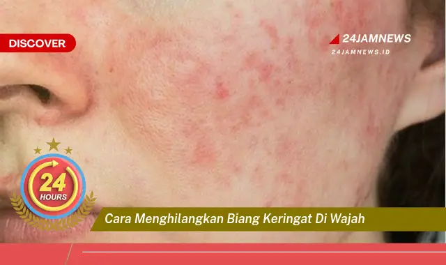 cara menghilangkan biang keringat di wajah