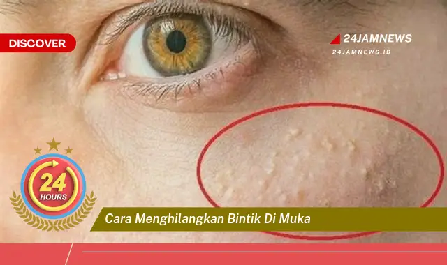 cara menghilangkan bintik di muka