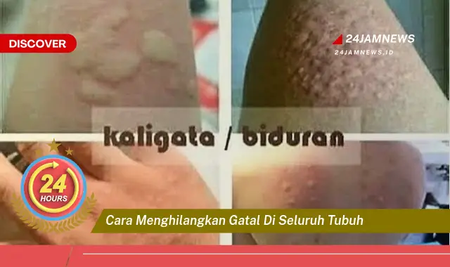 cara menghilangkan gatal di seluruh tubuh