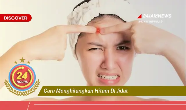 cara menghilangkan hitam di jidat