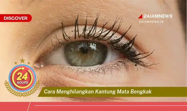 cara menghilangkan kantung mata bengkak