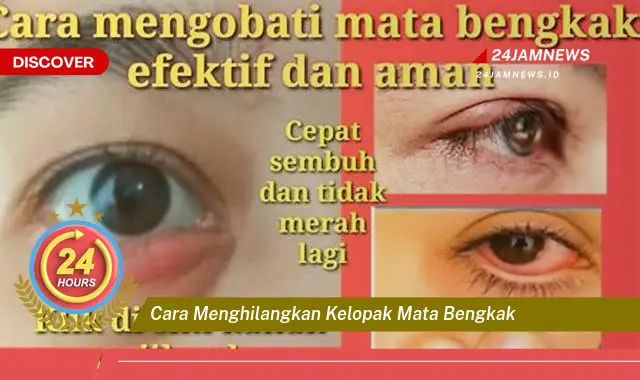 cara menghilangkan kelopak mata bengkak