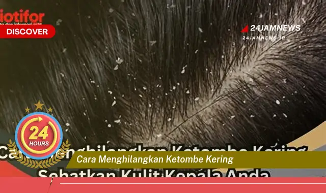 cara menghilangkan ketombe kering