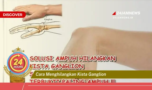 cara menghilangkan kista ganglion