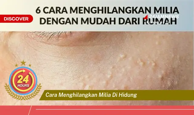 cara menghilangkan milia di hidung