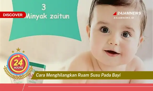 cara menghilangkan ruam susu pada bayi