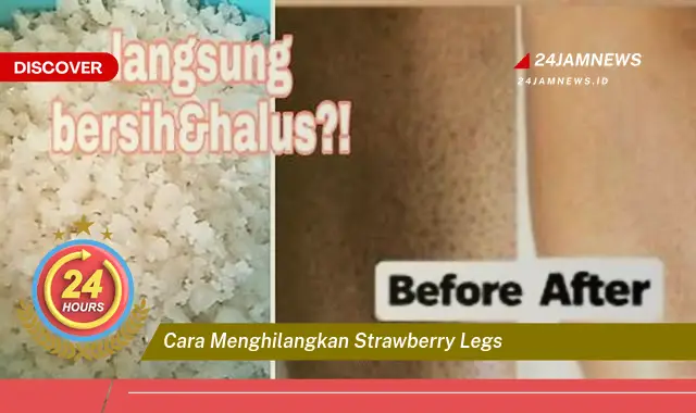 cara menghilangkan strawberry legs