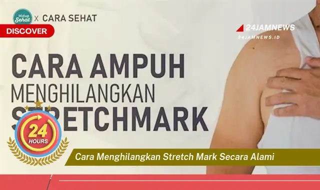 cara menghilangkan stretch mark secara alami