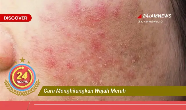 cara menghilangkan wajah merah