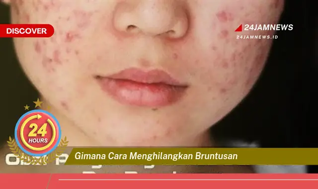 gimana cara menghilangkan bruntusan